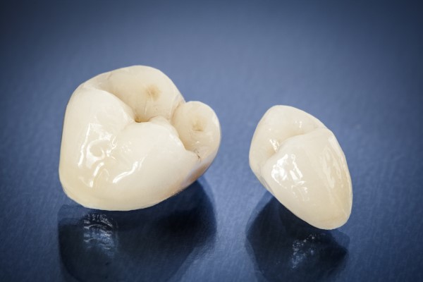 When Is A Dental Crown Necessary?